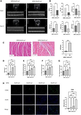 Inhibition of ferroptosis alleviates high-power microwave-induced myocardial injury